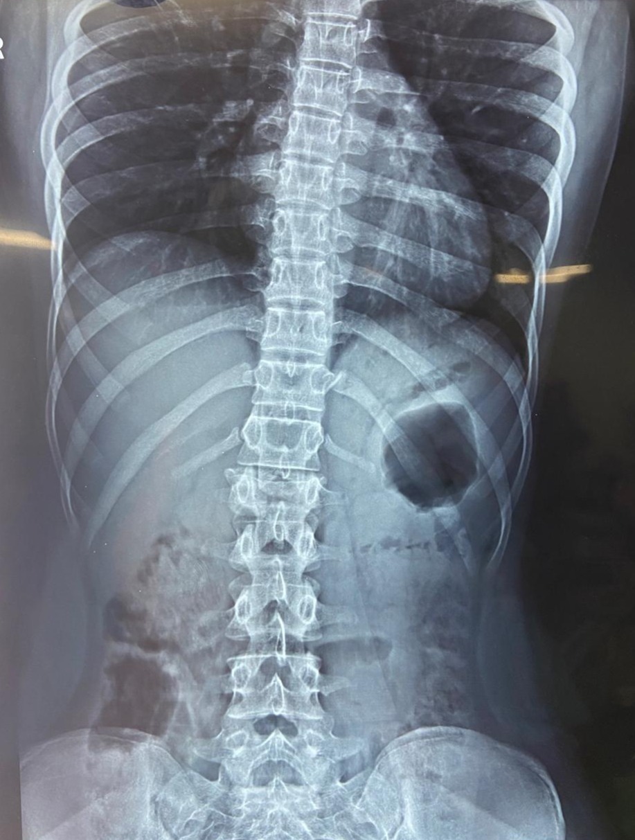 Pre-operation image 1