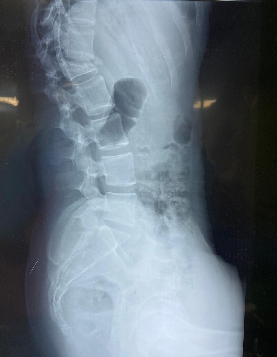 Pre-operation image 2