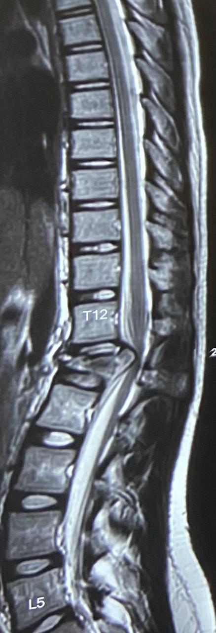 Pre-operation image 3