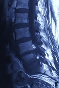 Pre-operation image 2