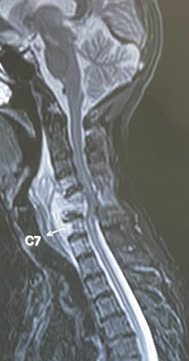 Pre-operation image 1