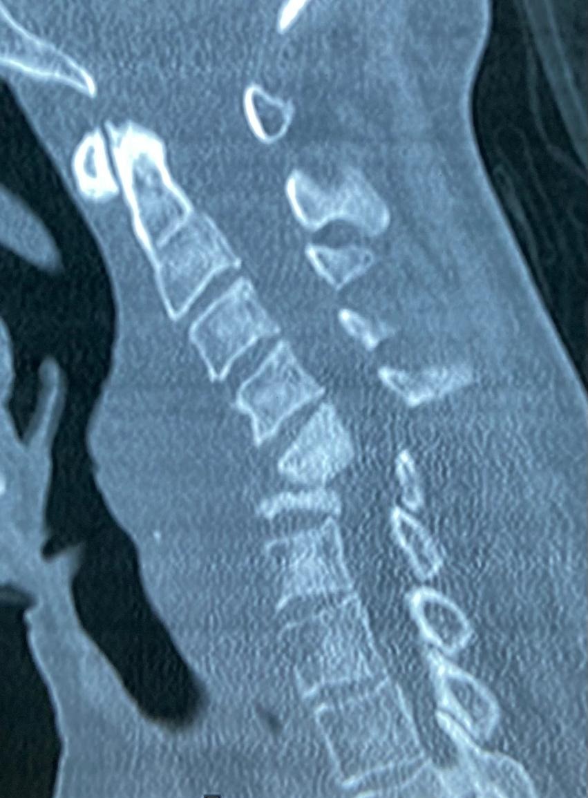 Pre-operation image 2