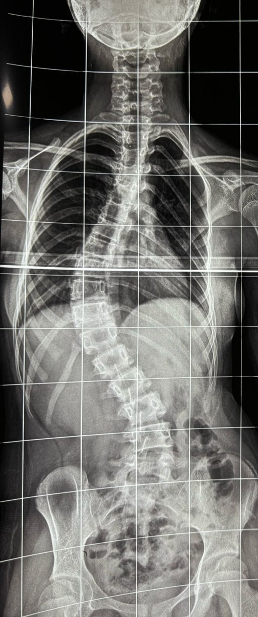 Pre-operation image 1